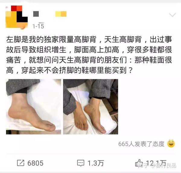 每个人的脚型不同常见的有三种脚型分别被称为埃及脚,罗马脚,希腊脚